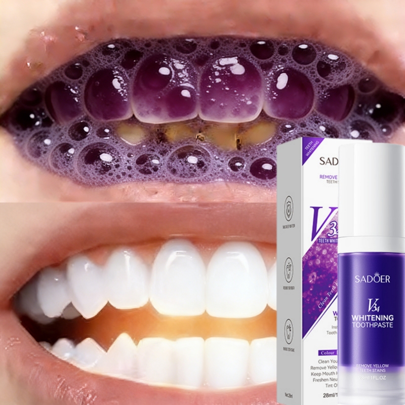 Teeth Whitening Effective - ยาสีฟันไวท์เทนนิ่งขายดีที่สุดปี 2026 ขจัดคราบเหลืองบนฟันและคราบพลัคได้อย่างมีประสิทธิภาพ ดูแลสุขภาพช่องปากและทำความสะอาดฟัน