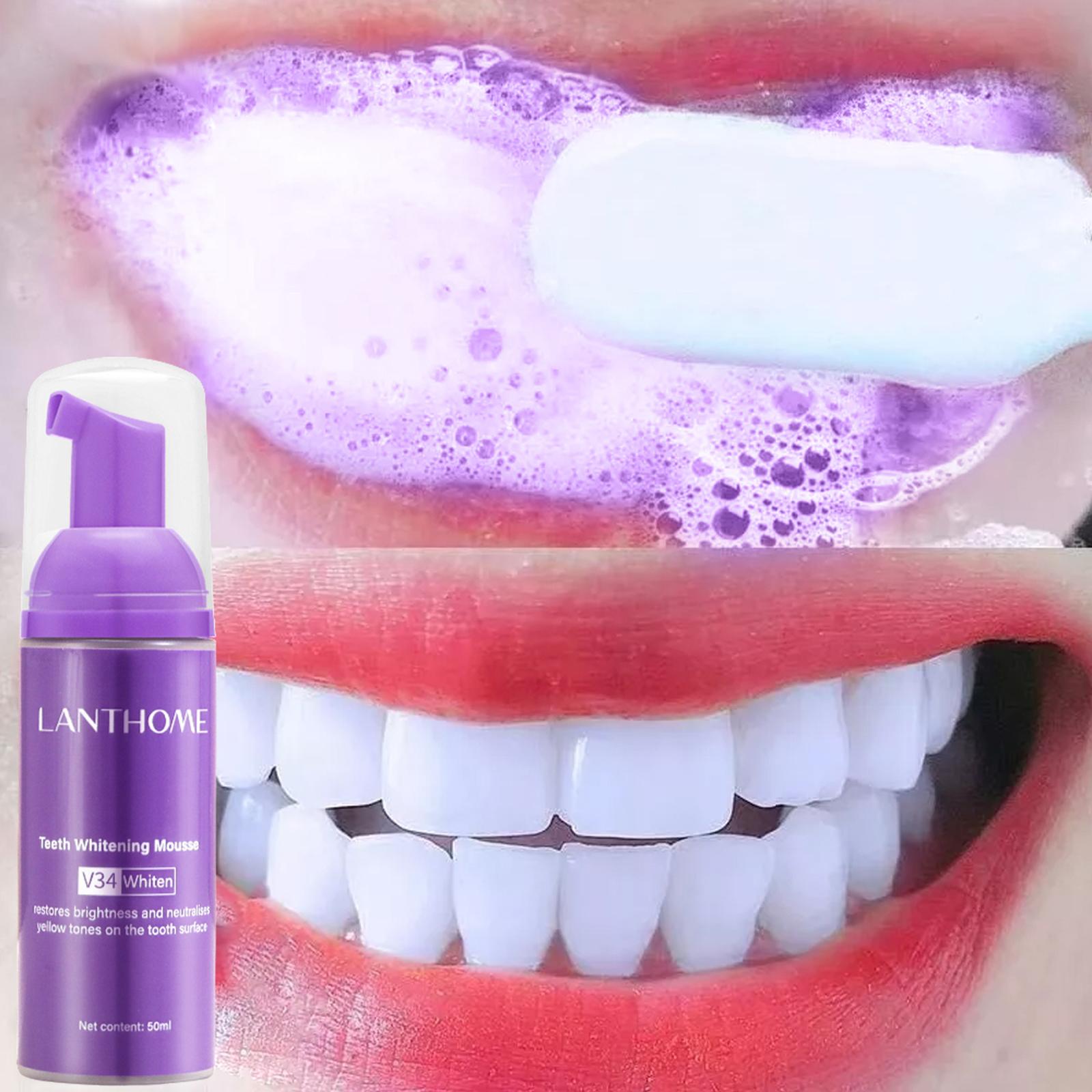 Teeth Whitening Effective - V34 มูสทําความสะอาดฟันยาสีฟันที่มีประสิทธิภาพ Brightening ฟันลบ Deep Whitening