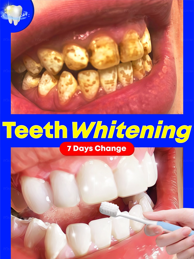Teeth Whitening Effective - เทคโนโลยีสีดําใหม่ปี 2025 เพื่อฟันขาวทําความสะอาดปัญหาช่องปากได้อย่างมีประสิทธิภาพ