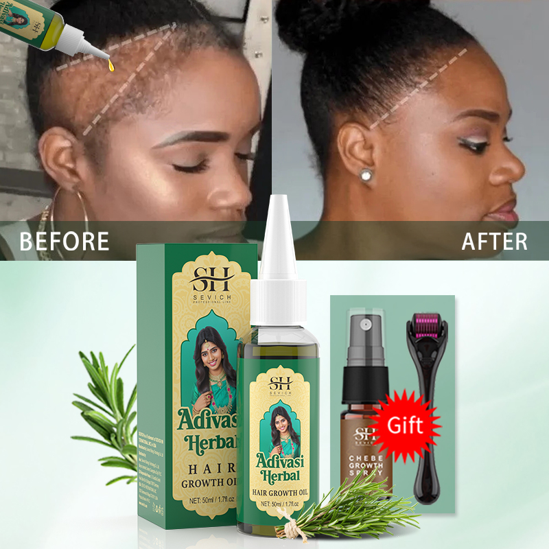 น้ำมันบำรุงผมอายุรเวทจากอินเดี - Coconut Oil Pull บทวิจารณ์และราคา