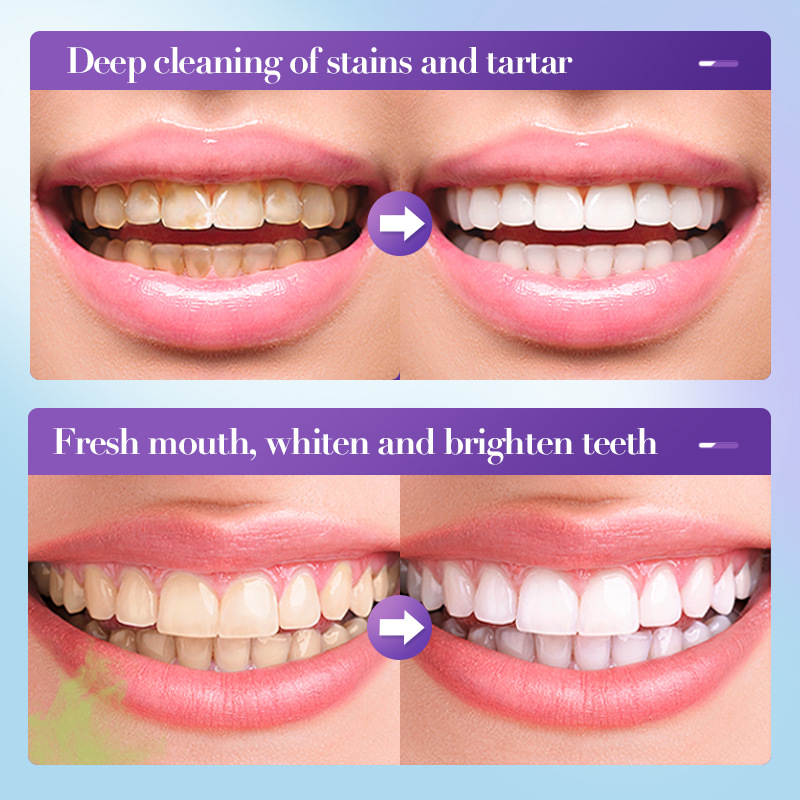 ยาสีฟันไวท์เทนนิ่งขายดีที่สุดป - Teeth Whitening Effective บทวิจารณ์และราคา