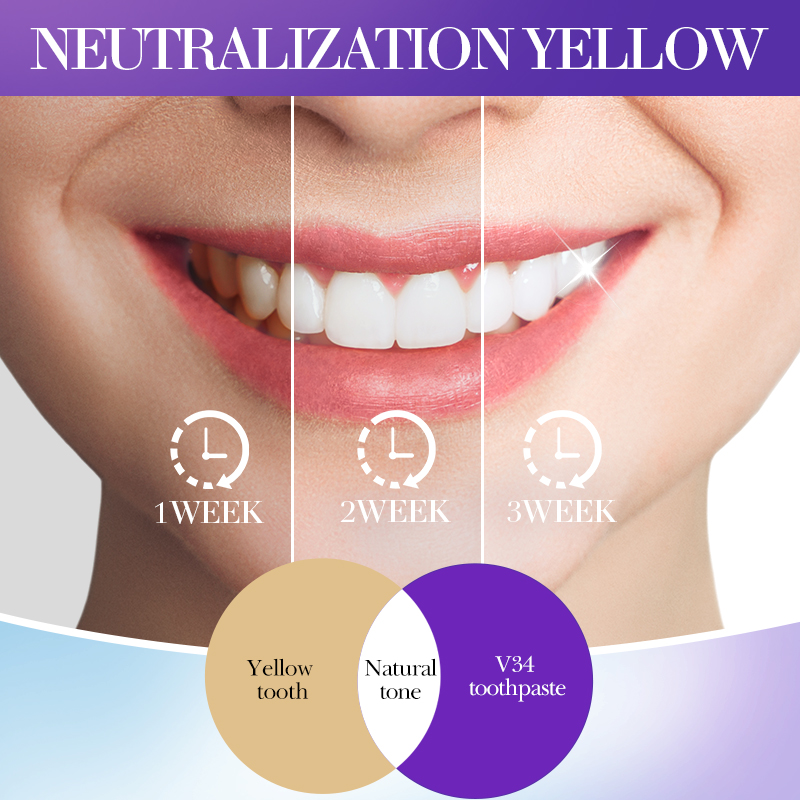 SADOER V34 ยาสีฟันขจัดคราบสําห - Teeth Whitening Hismile บทวิจารณ์และราคา