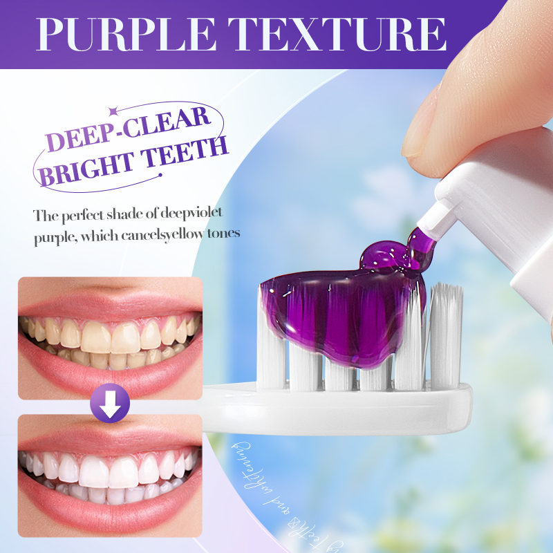 SADOER V34 ยาสีฟันขจัดคราบสําห - Teeth Whitening Hismile บทวิจารณ์และราคา