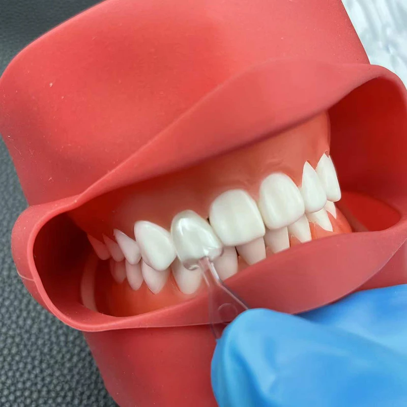 1 ชุด/3 ชุด/5 ชุด แม่พิมพ์วีเน - Teeth Whitening Moulds บทวิจารณ์และราคา