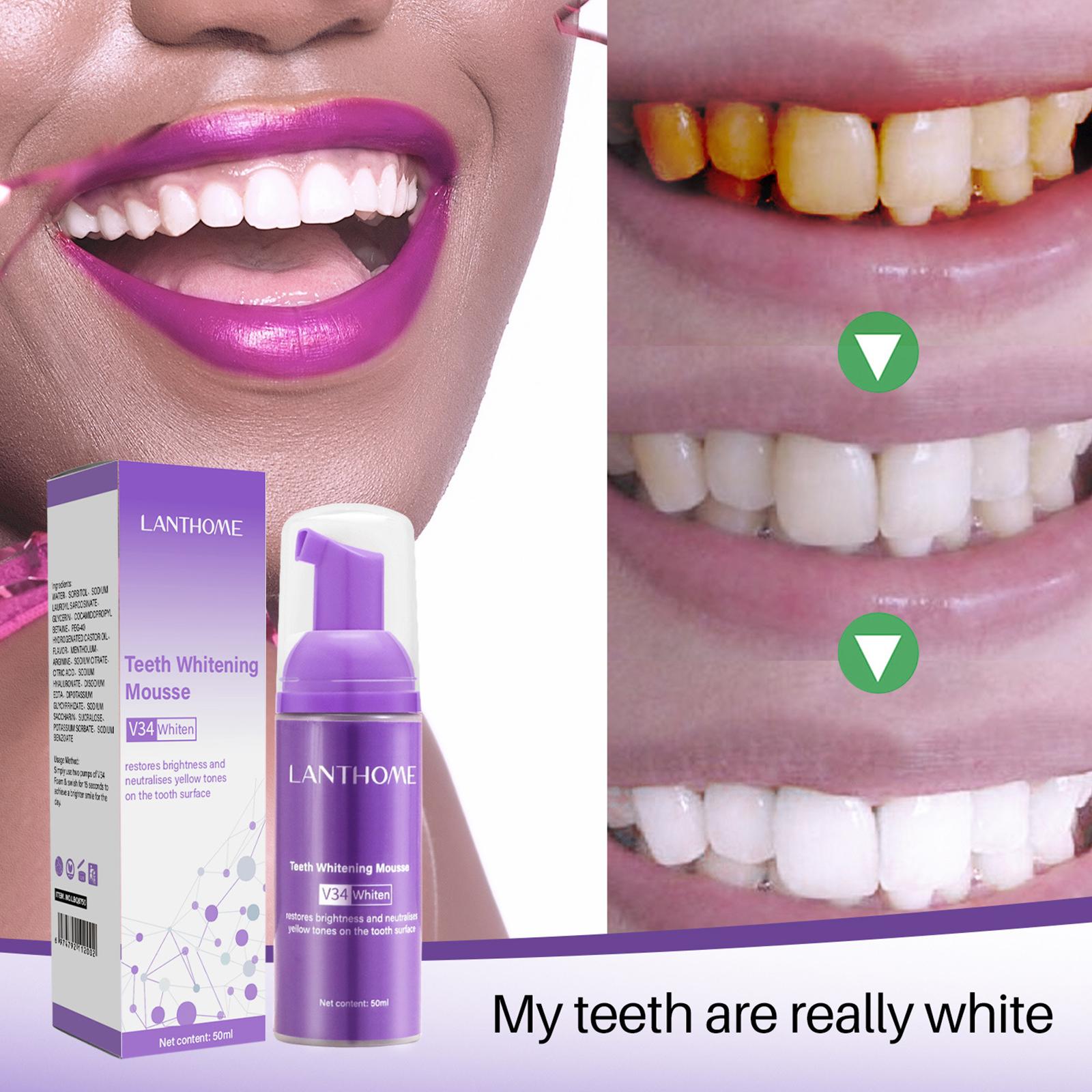 V34 มูสทําความสะอาดฟันยาสีฟันท - Teeth Whitening Effective บทวิจารณ์และราคา