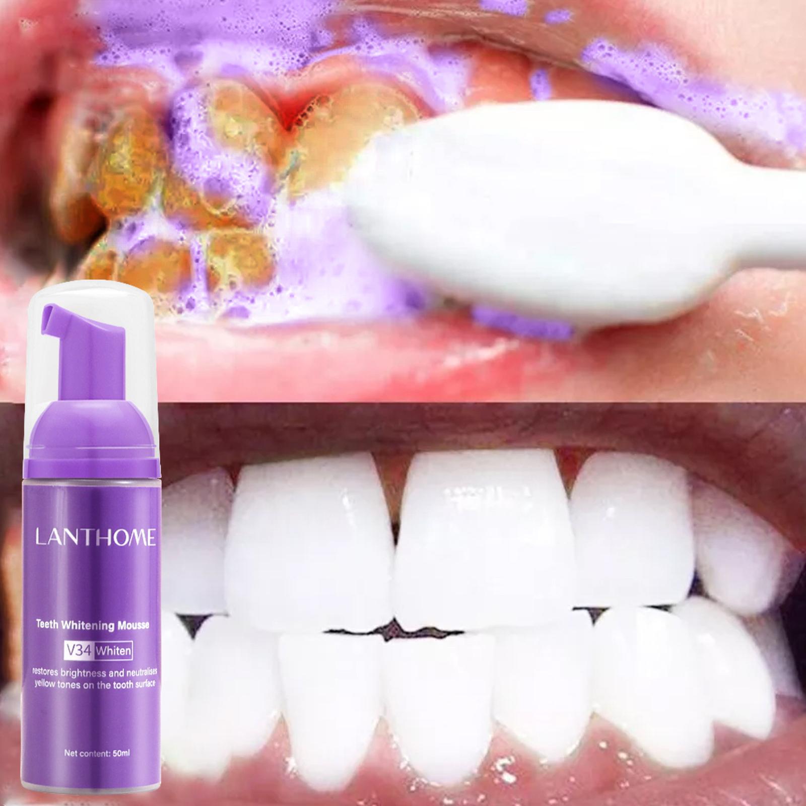 V34 มูสทําความสะอาดฟันยาสีฟันท - Teeth Whitening Effective บทวิจารณ์และราคา