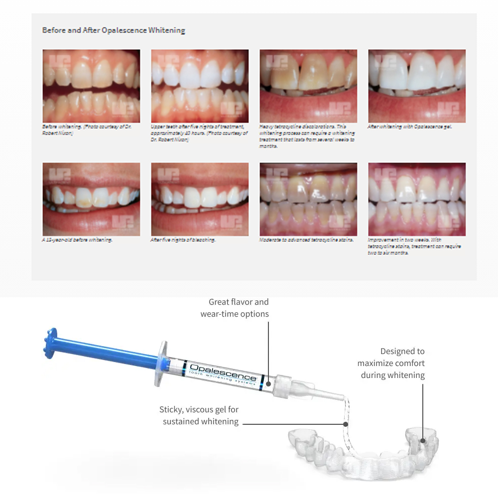 20% pF 20 16ชุดเจล8x1.2มล. ชุด - Teeth Whitening Hismile บทวิจารณ์และราคา