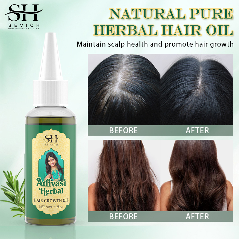 เซรั่มการเจริญเติบโตของเส้นผมน - Coconut Oil Pull บทวิจารณ์และราคา