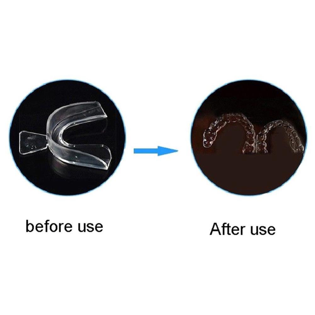 ที่ครอบฟันซิลิโคนสำหรับจัดฟัน  - Teeth Whitening Mouth Guard บทวิจารณ์และราคา