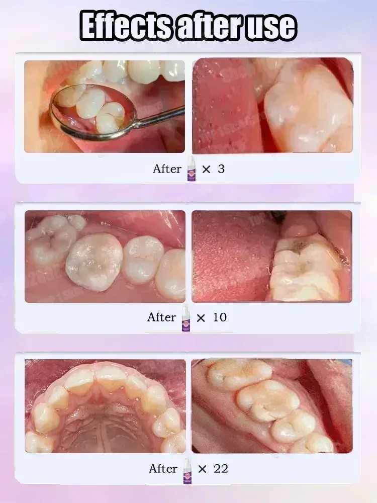 ขายดีที่สุด ซ่อมแซมฟันผุทางวิท - Teeth Whitening Cream บทวิจารณ์และราคา