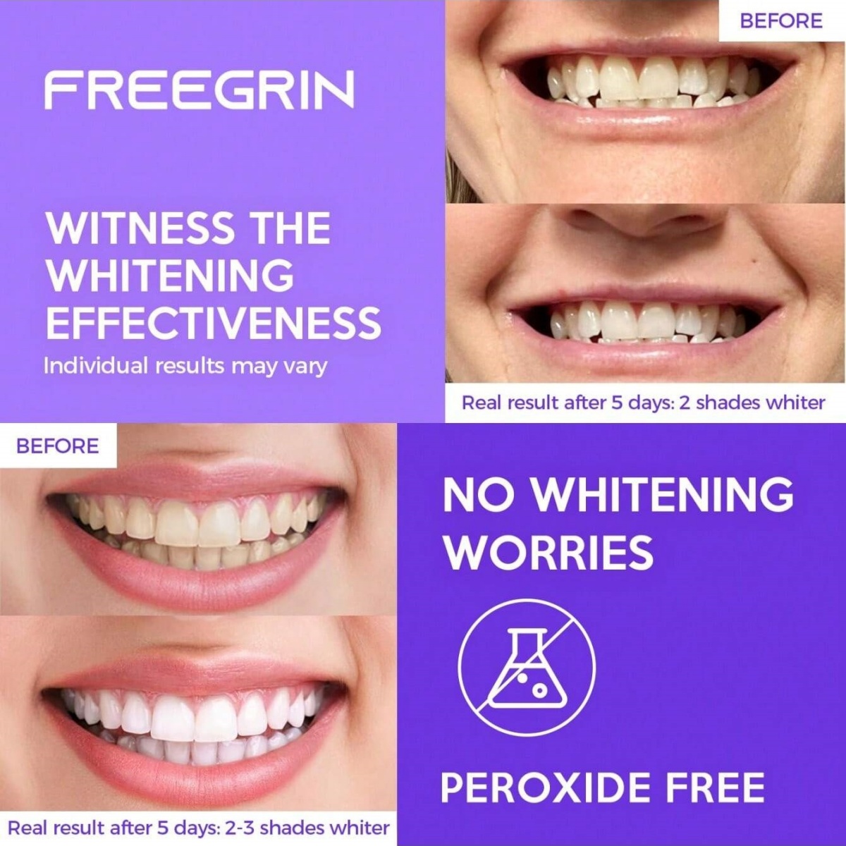 ดีลักซ์สติกเกอร์ฟอกสีฟัน 7/14/ - Teeth Whitening Hismile บทวิจารณ์และราคา