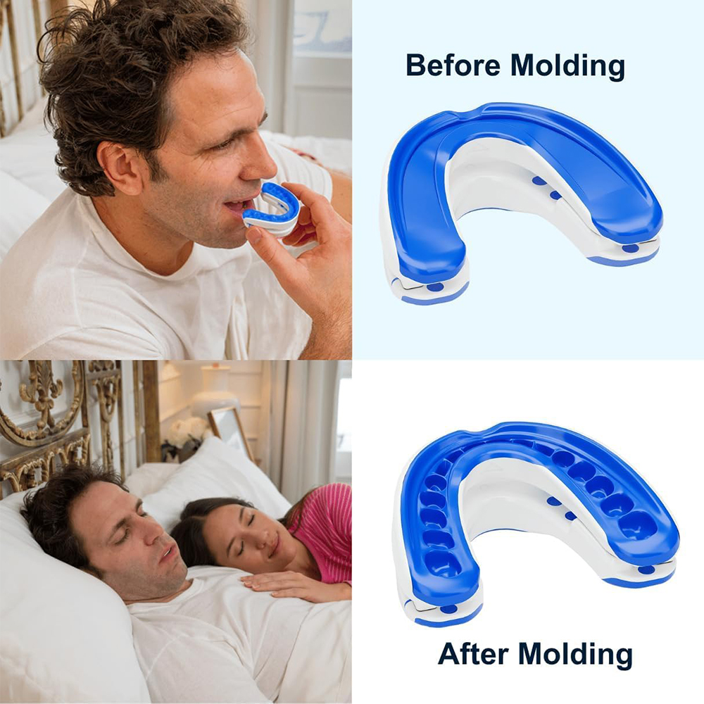 Anti-Snoring Mouthpiece Anti-S - Teeth Whitening Mouth Guard บทวิจารณ์และราคา