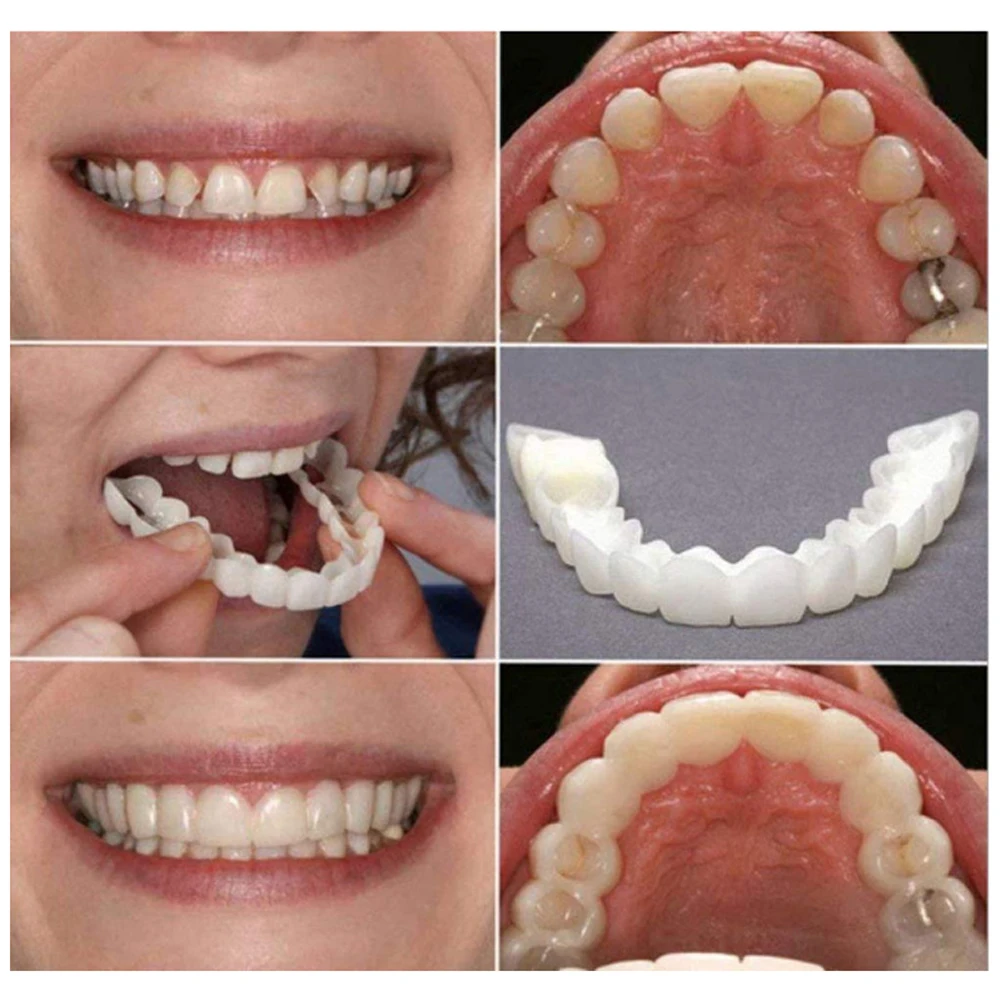 ฟันปลอม2คู่ Comfort ดูแลฟันฟัน - Teeth Whitening Mouth Guard บทวิจารณ์และราคา